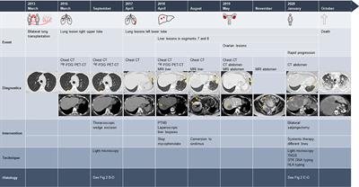 Case Report: An Unusual Course of Angiosarcoma After Lung Transplantation